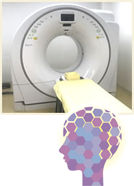 CT・脳の健康相談イメージ
