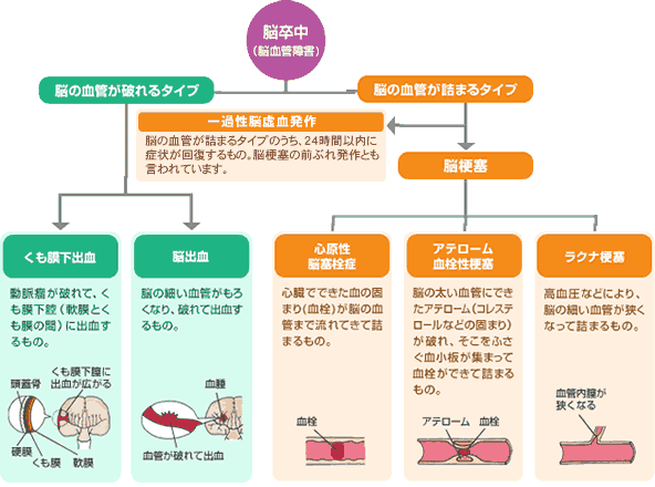 脳卒中でお悩みの方へ