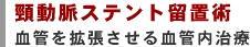 頸動脈ステント留置術：血管を拡張させる血管内治療